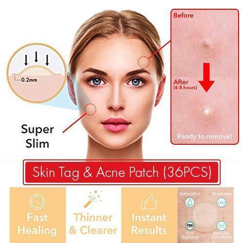 Skin Tag and Acne Patch 24pcs