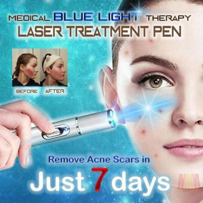 Medical Blue Light Therapy Laser Treatment Pen