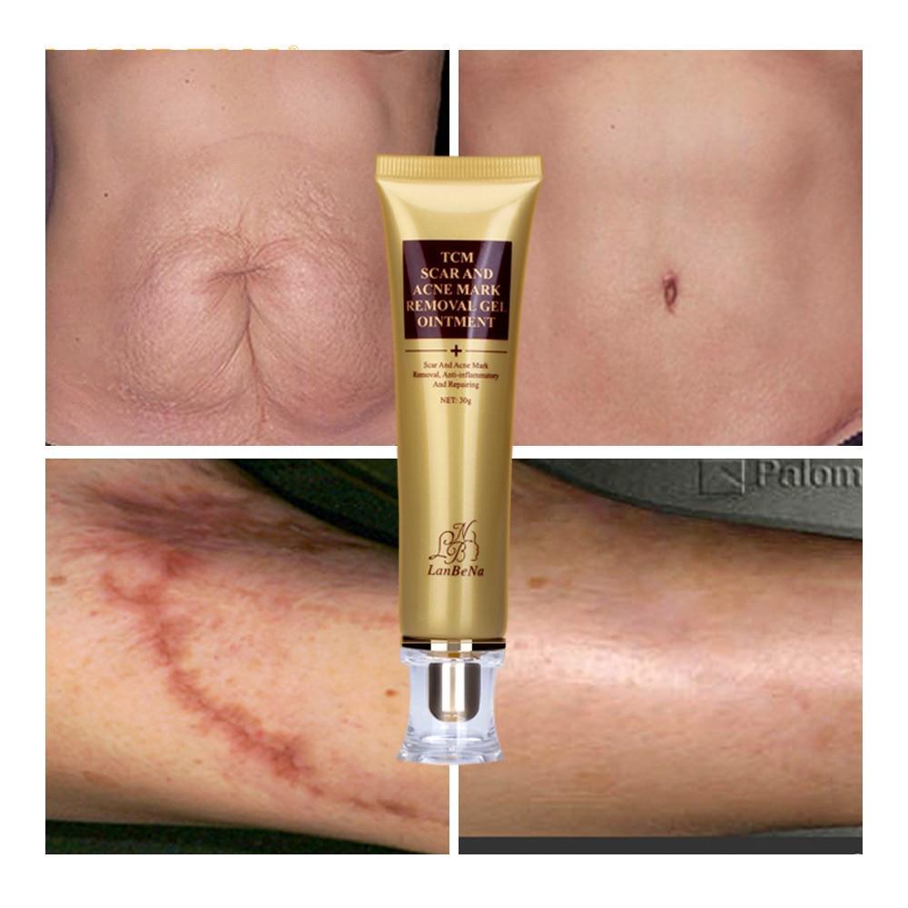 Acne Scar Removal Cream Skin Care Ginseng Extract